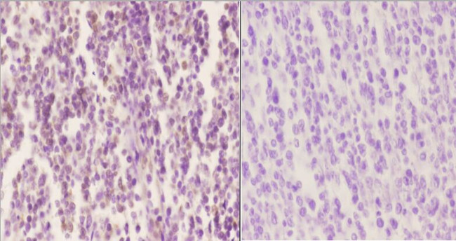 Phospho-SOX9 (Ser181) Antibody in Immunohistochemistry (Paraffin) (IHC (P))