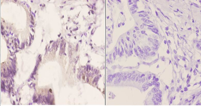 Phospho-SOX9 (Ser181) Antibody in Immunohistochemistry (Paraffin) (IHC (P))