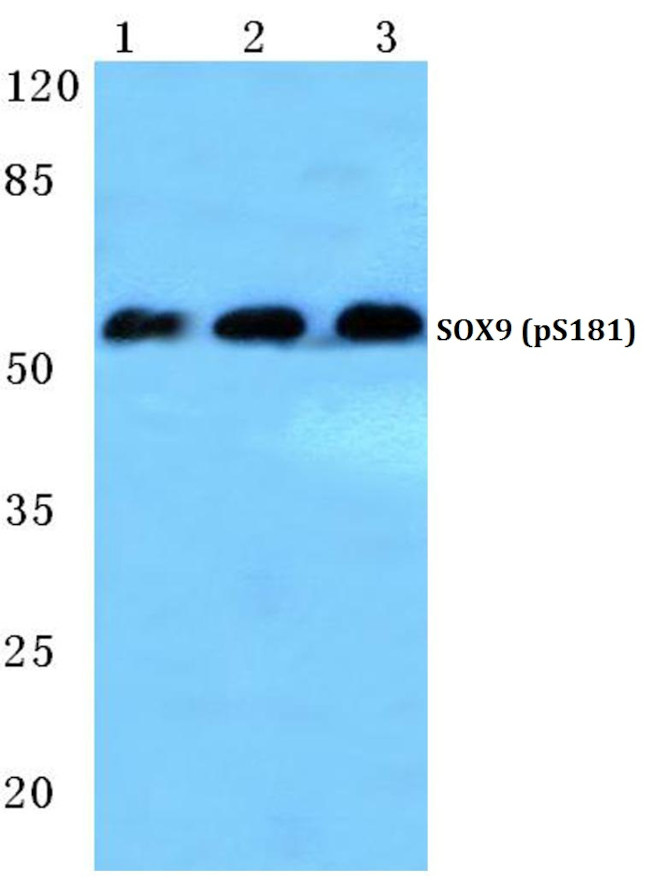 Phospho-SOX9 (Ser181) Antibody in Western Blot (WB)