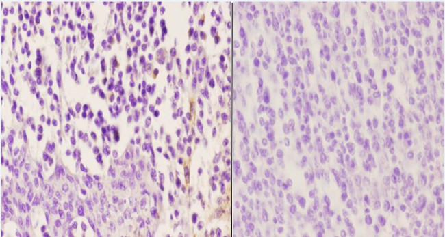 Phospho-Zap-70 (Tyr315) Antibody in Immunohistochemistry (Paraffin) (IHC (P))