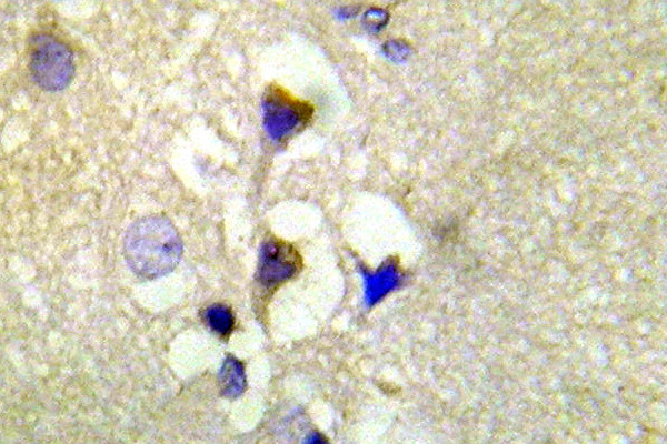 Phospho-PKC mu (Ser910) Antibody in Immunohistochemistry (Paraffin) (IHC (P))