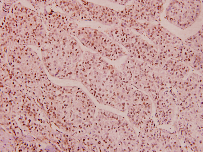 Phospho-HDAC1 (Ser421, Ser423) Antibody in Immunohistochemistry (Paraffin) (IHC (P))