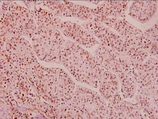 Phospho-HDAC1 (Ser421, Ser423) Antibody in Immunohistochemistry (Paraffin) (IHC (P))