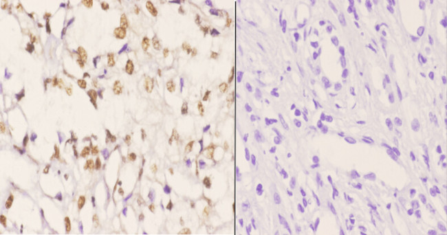 AKAP8 Antibody in Immunohistochemistry (Paraffin) (IHC (P))