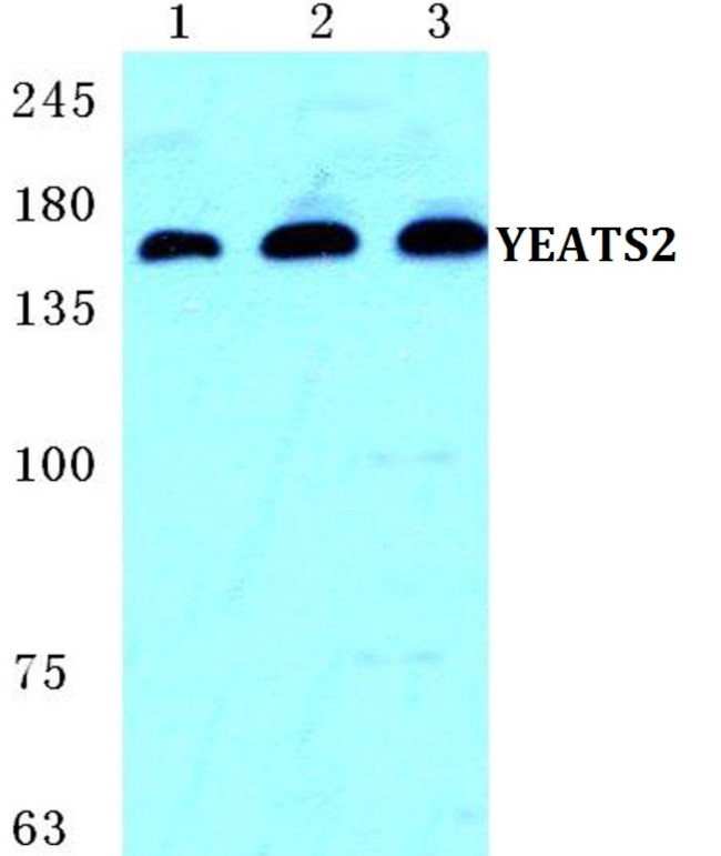 YEATS2 Antibody in Western Blot (WB)