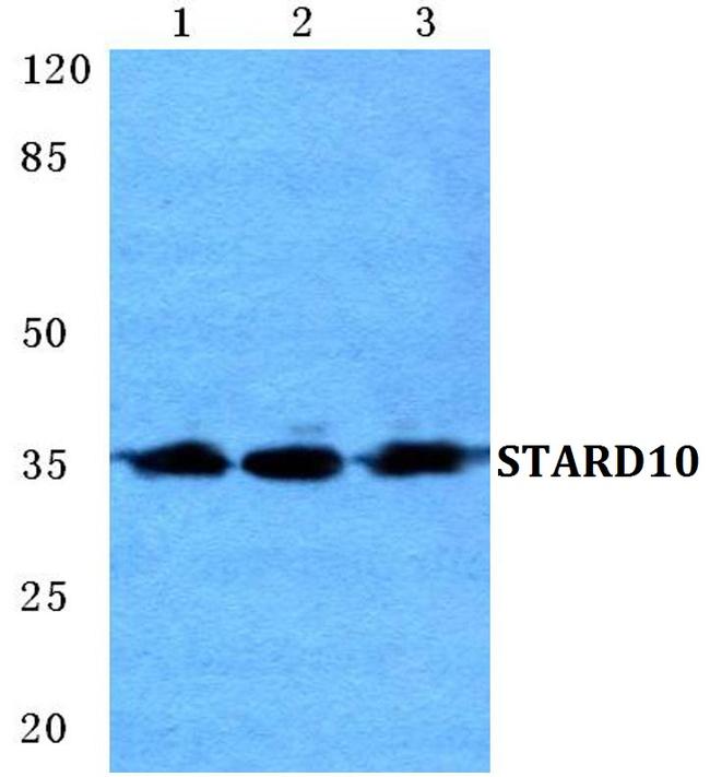 STARD10 Antibody in Western Blot (WB)