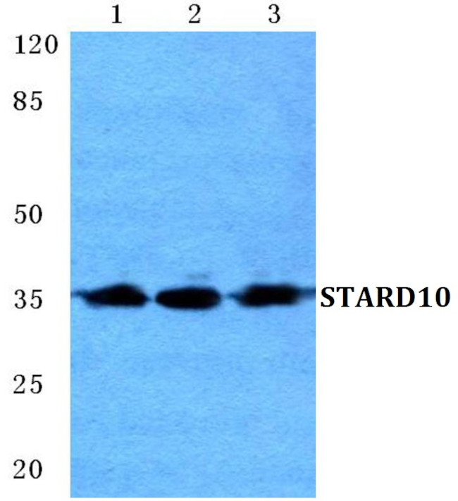 STARD10 Antibody in Western Blot (WB)