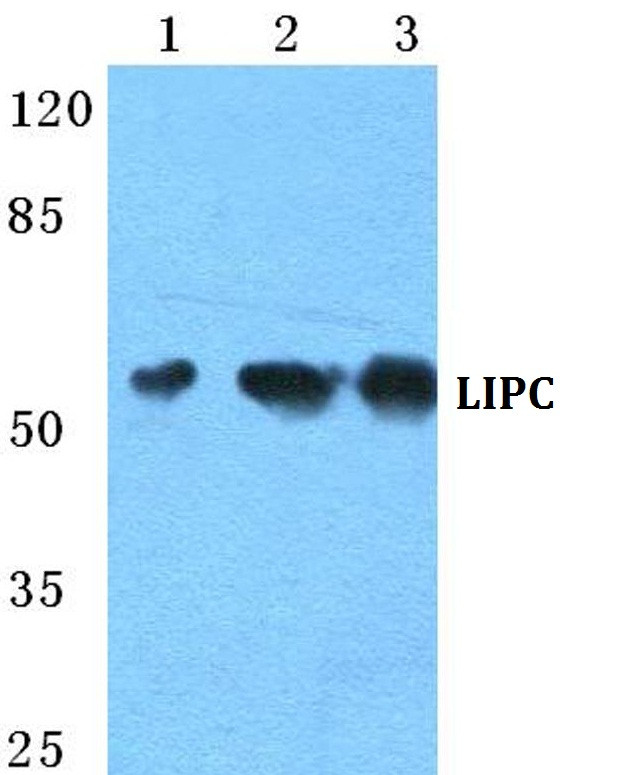 LIPC Antibody in Western Blot (WB)