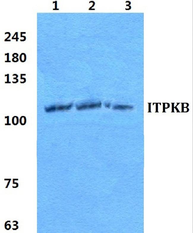 ITPKB Antibody in Western Blot (WB)