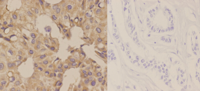 KCNAB3 Antibody in Immunohistochemistry (Paraffin) (IHC (P))