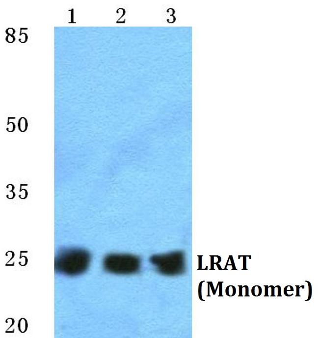 LRAT Antibody in Western Blot (WB)