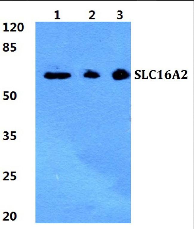 SLC16A2 Antibody in Western Blot (WB)