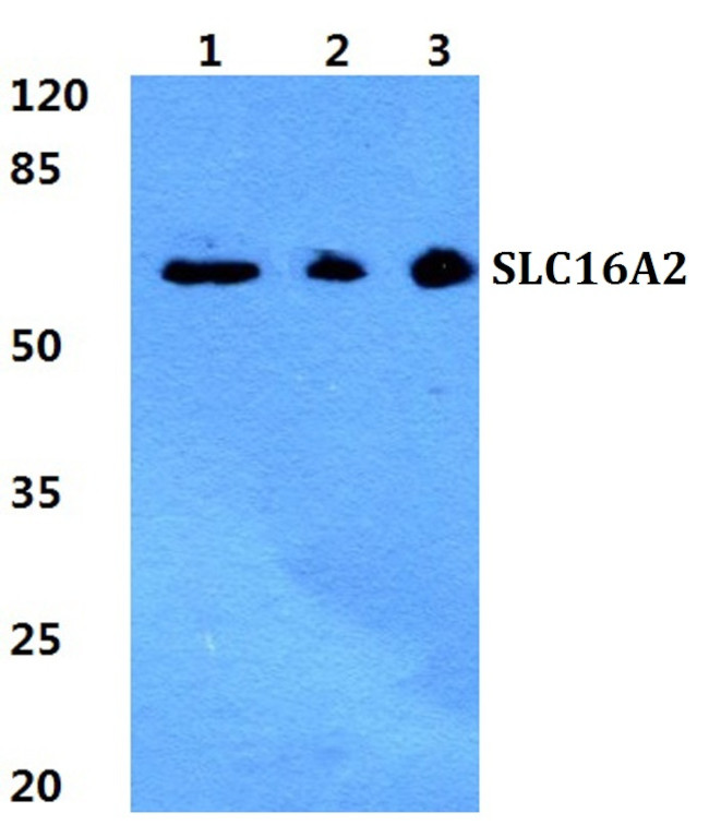 SLC16A2 Antibody in Western Blot (WB)