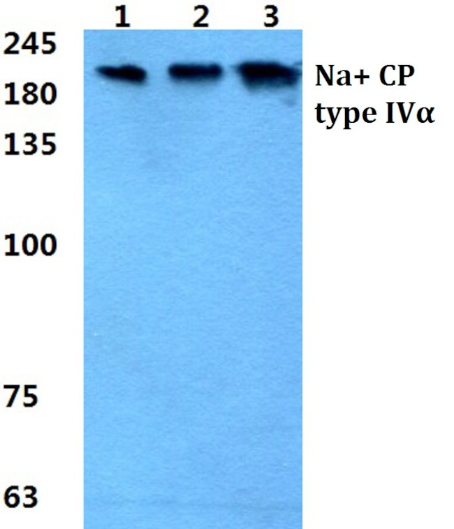 SCN4A Antibody in Western Blot (WB)