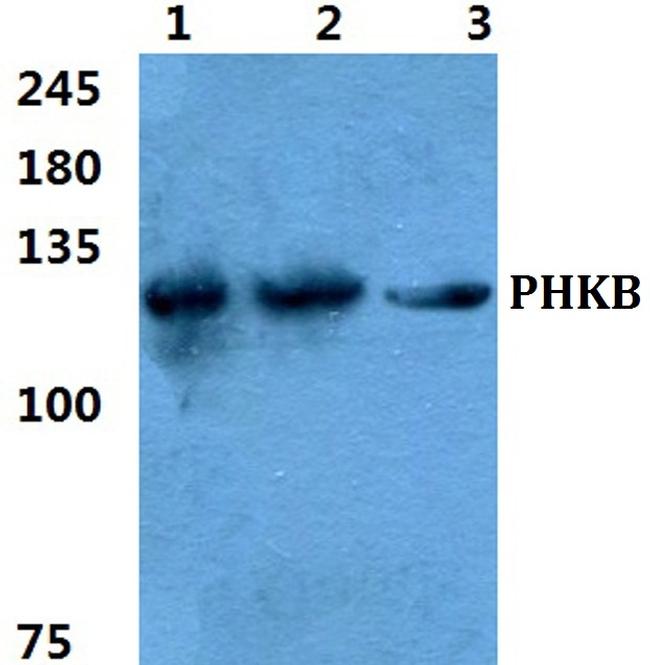 PHKB Antibody in Western Blot (WB)