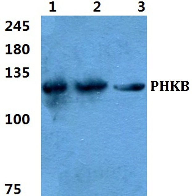 PHKB Antibody in Western Blot (WB)