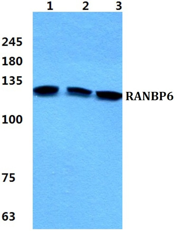 RANBP6 Antibody in Western Blot (WB)