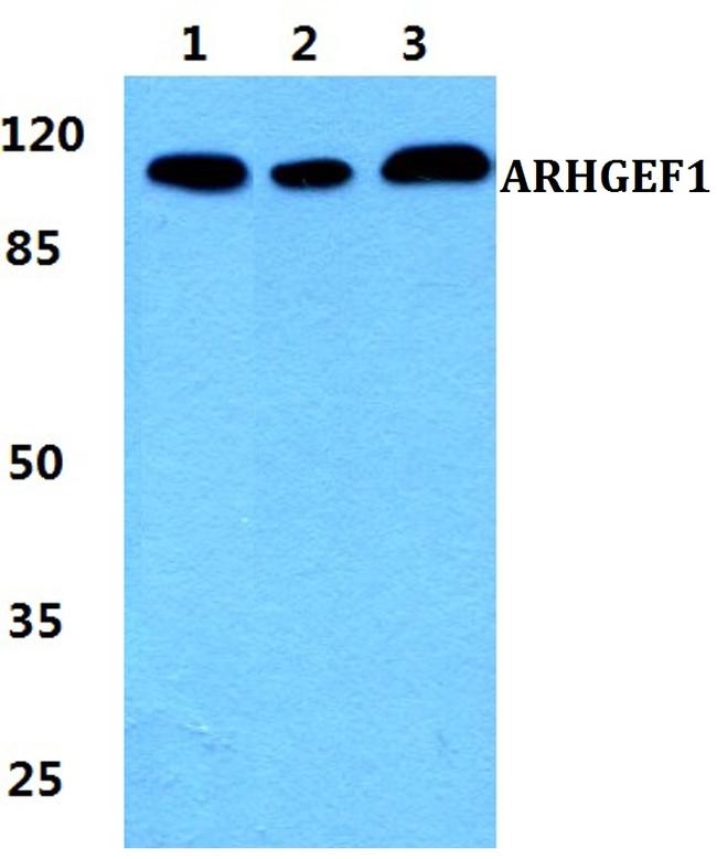 ARHGEF1 Antibody in Western Blot (WB)