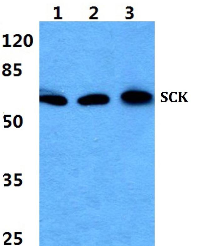 SCK Antibody in Western Blot (WB)