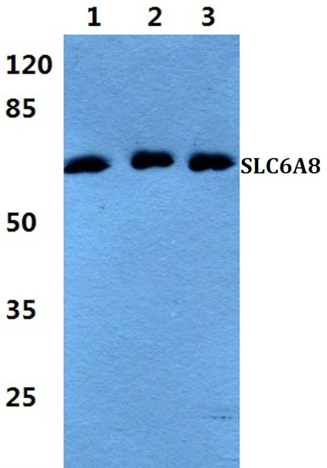 SLC6A8 Antibody in Western Blot (WB)