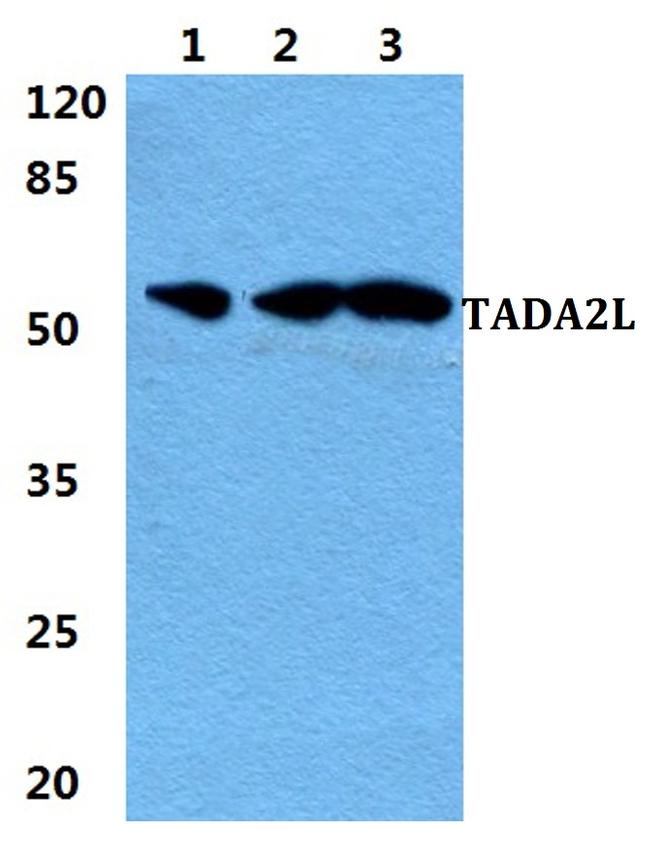 TADA2L Antibody in Western Blot (WB)