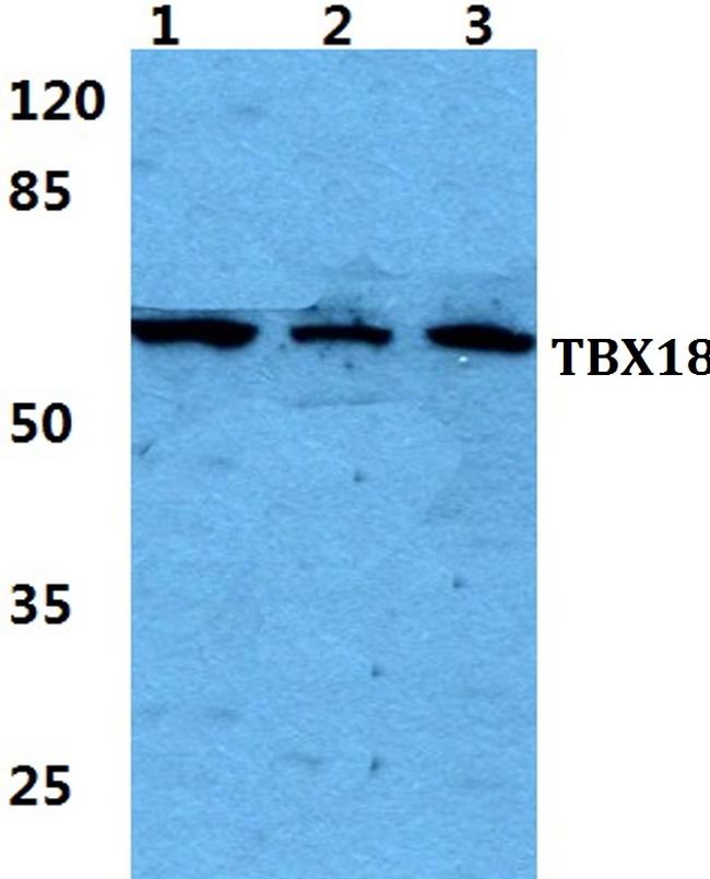TBX18 Antibody in Western Blot (WB)