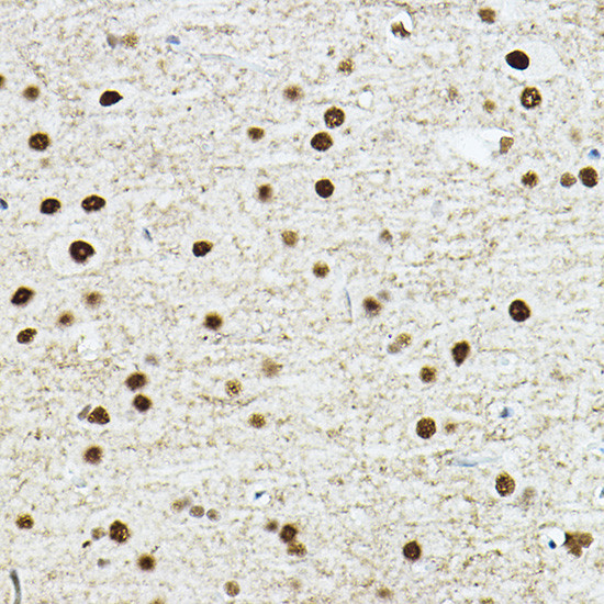 TEF1 Antibody in Immunohistochemistry (Paraffin) (IHC (P))