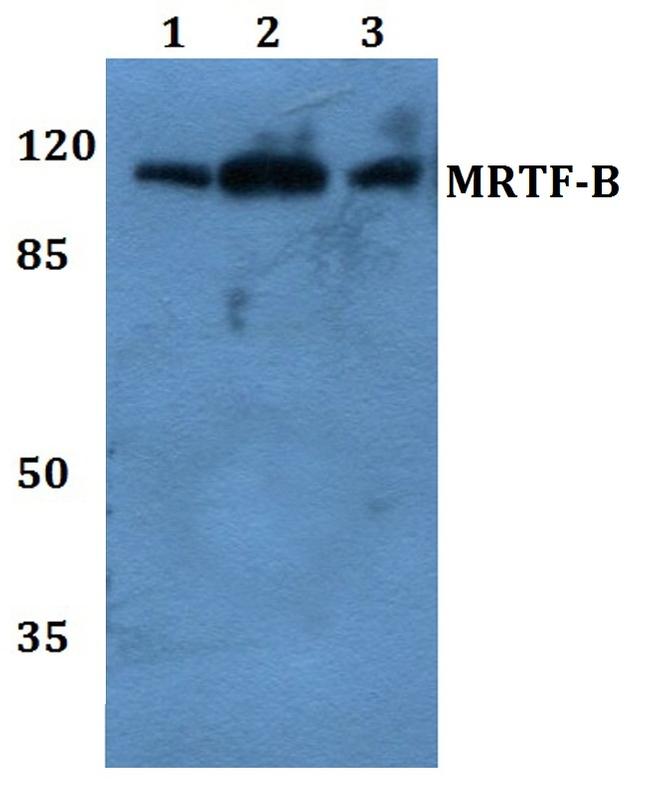 MKL2 Antibody in Western Blot (WB)