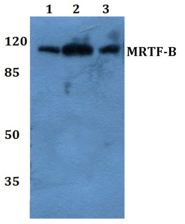 MKL2 Antibody in Western Blot (WB)