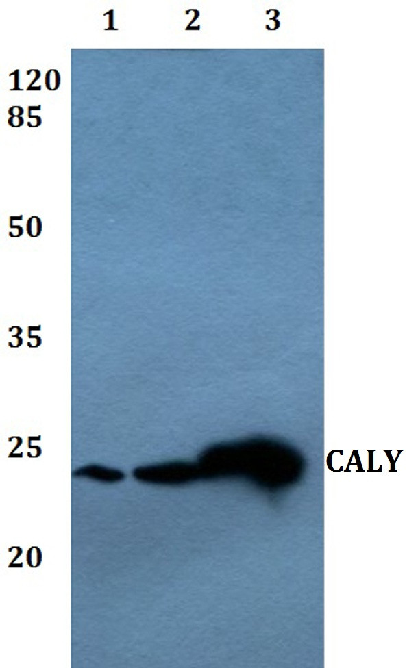 CALY Antibody in Western Blot (WB)