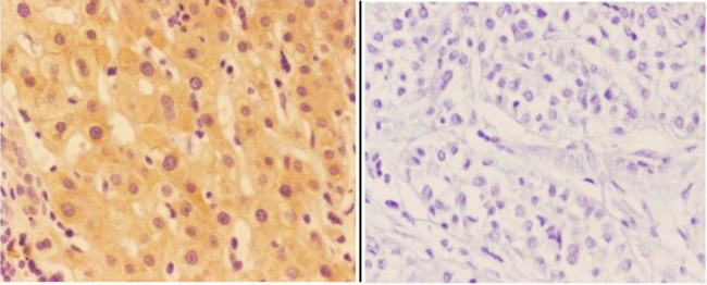 Agrin Antibody in Immunohistochemistry (Paraffin) (IHC (P))