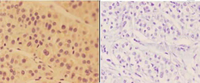 ALDH3B2 Antibody in Immunohistochemistry (Paraffin) (IHC (P))