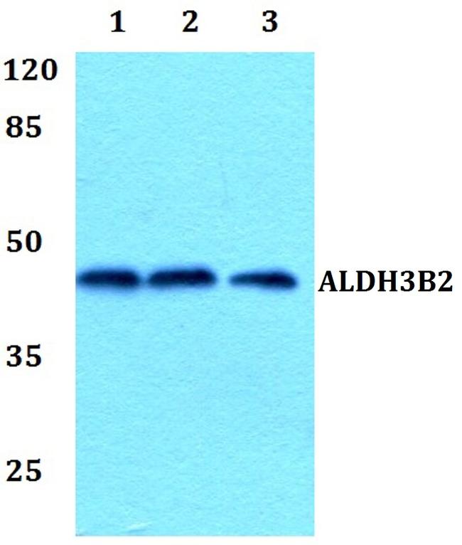 ALDH3B2 Antibody in Western Blot (WB)