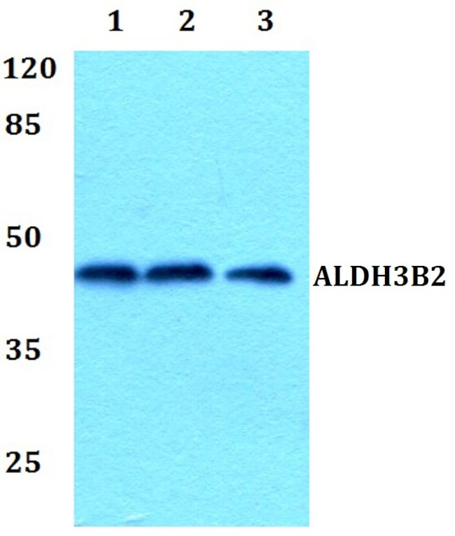 ALDH3B2 Antibody in Western Blot (WB)