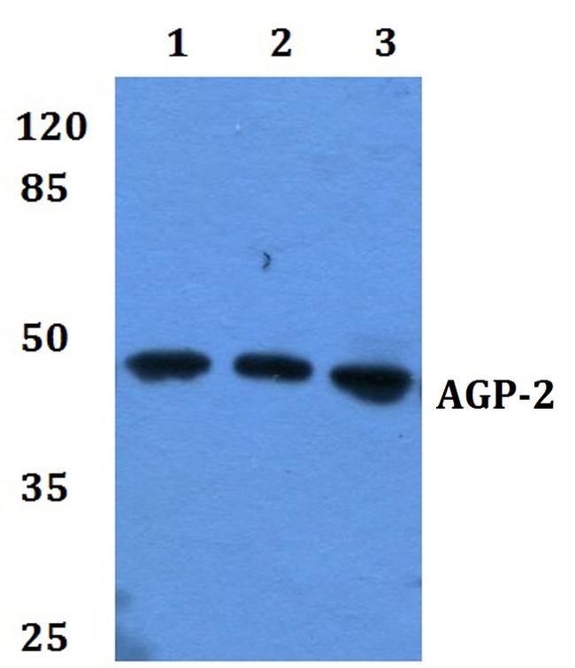 ORM2 Antibody in Western Blot (WB)