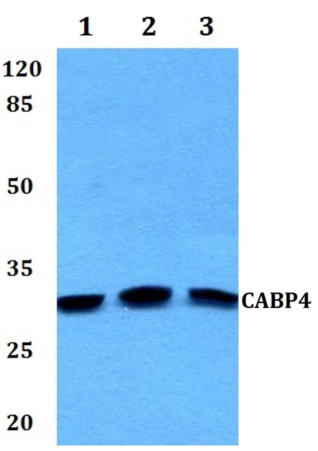 CABP4 Antibody in Western Blot (WB)