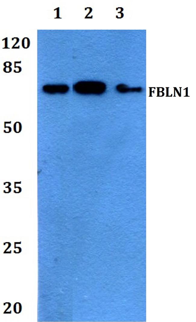 Fibulin 1 Antibody in Western Blot (WB)