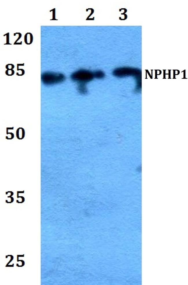 NPHP1 Antibody in Western Blot (WB)