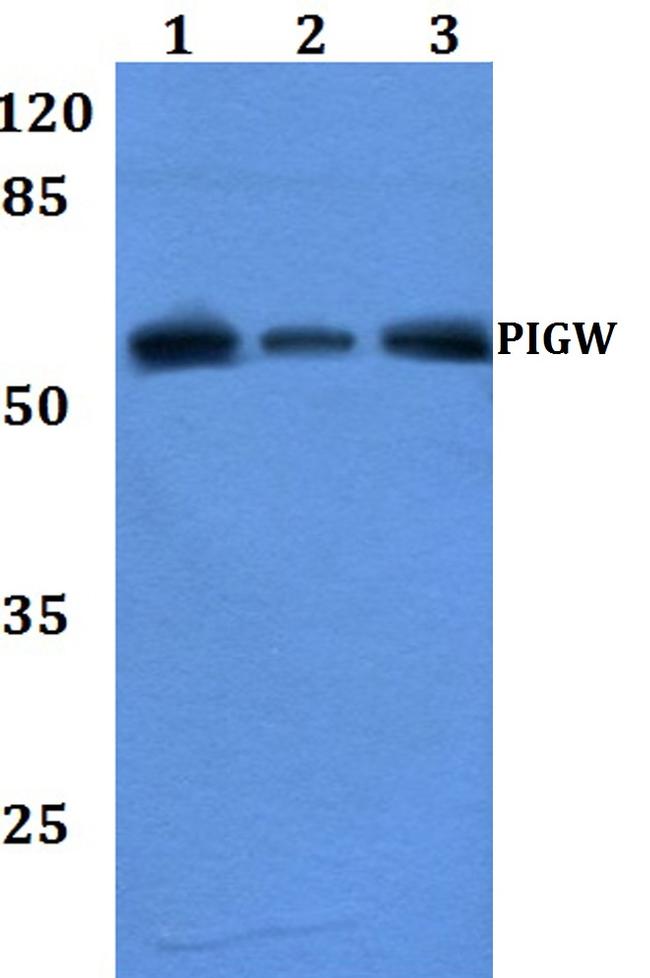 PIGW Antibody in Western Blot (WB)