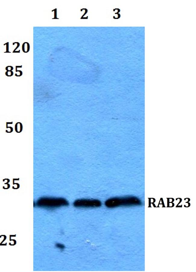 RAB23 Antibody in Western Blot (WB)