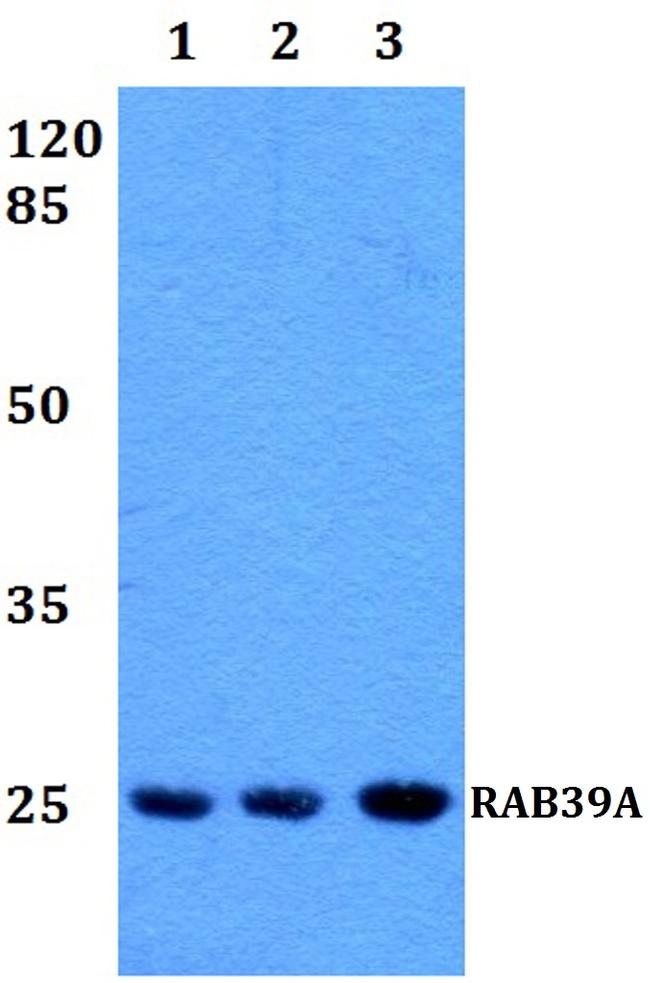 RAB39A Antibody in Western Blot (WB)