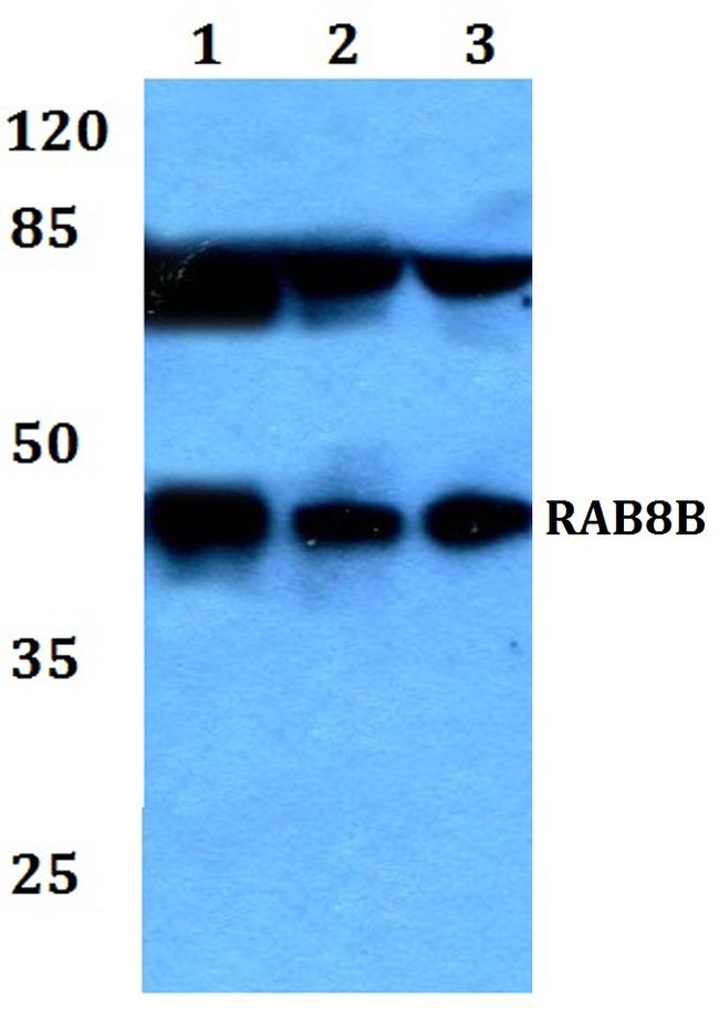 RAB8B Antibody in Western Blot (WB)