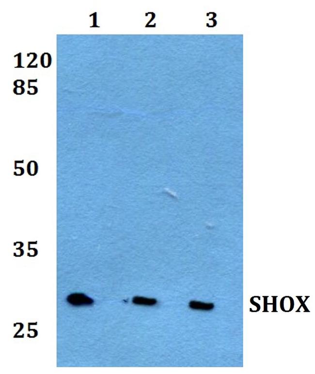 SHOX Antibody in Western Blot (WB)