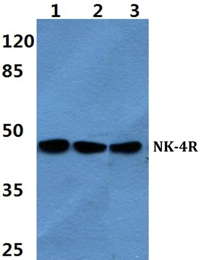 NK-4R Antibody in Western Blot (WB)