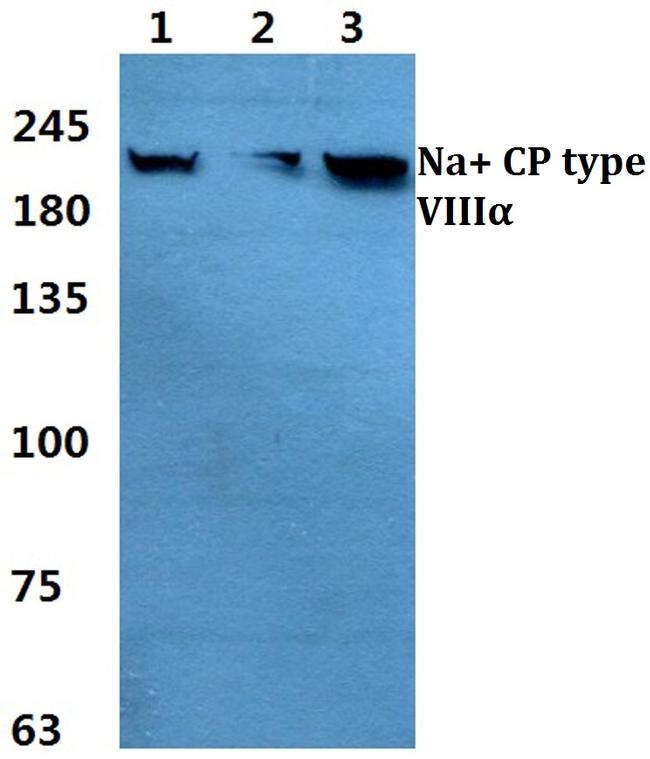 SCN8A Antibody in Western Blot (WB)