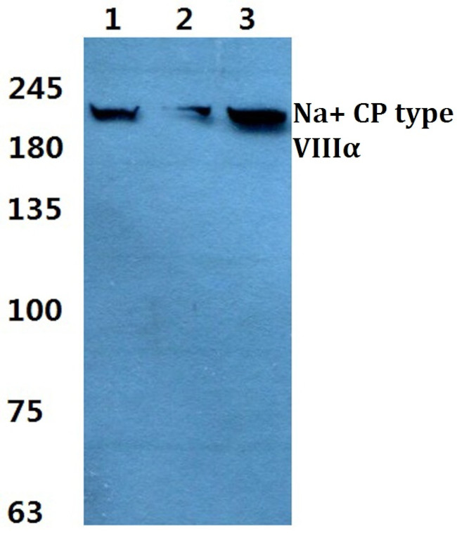 SCN8A Antibody in Western Blot (WB)