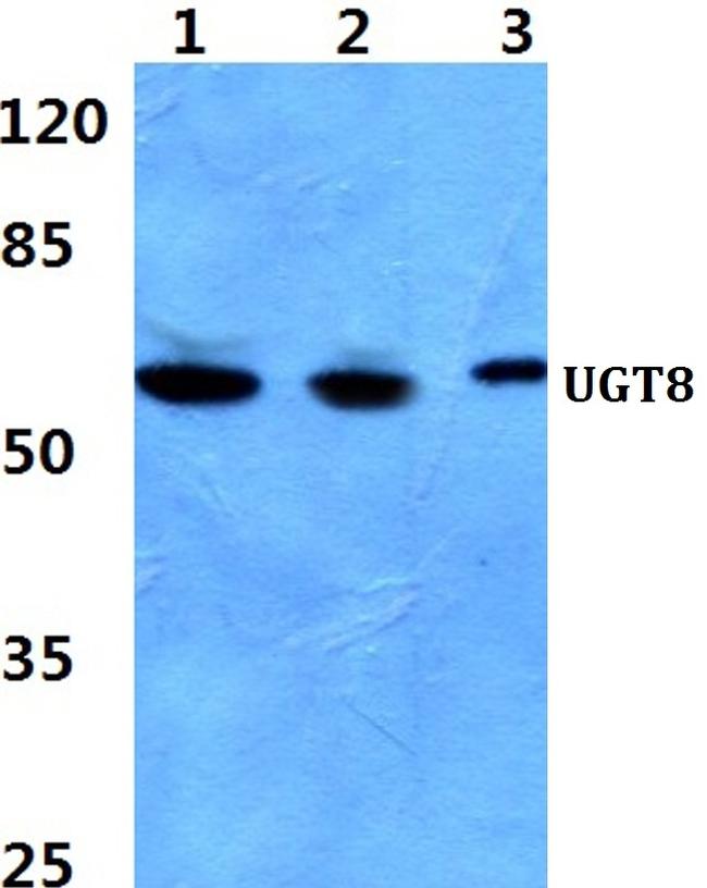 UGT8 Antibody in Western Blot (WB)