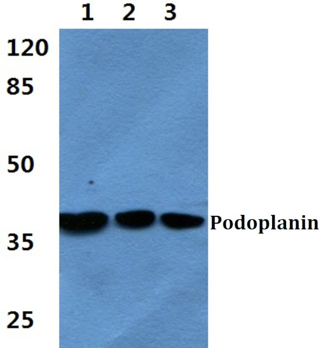 Podoplanin Antibody in Western Blot (WB)