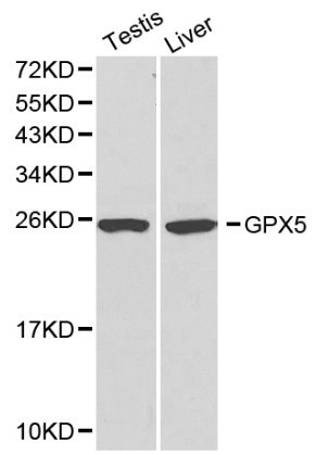 GPX5 Antibody in Western Blot (WB)