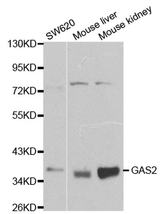 GAS2 Antibody in Western Blot (WB)